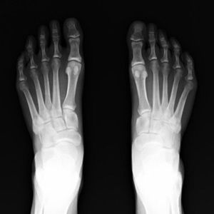 Meet your Posher, Shawn